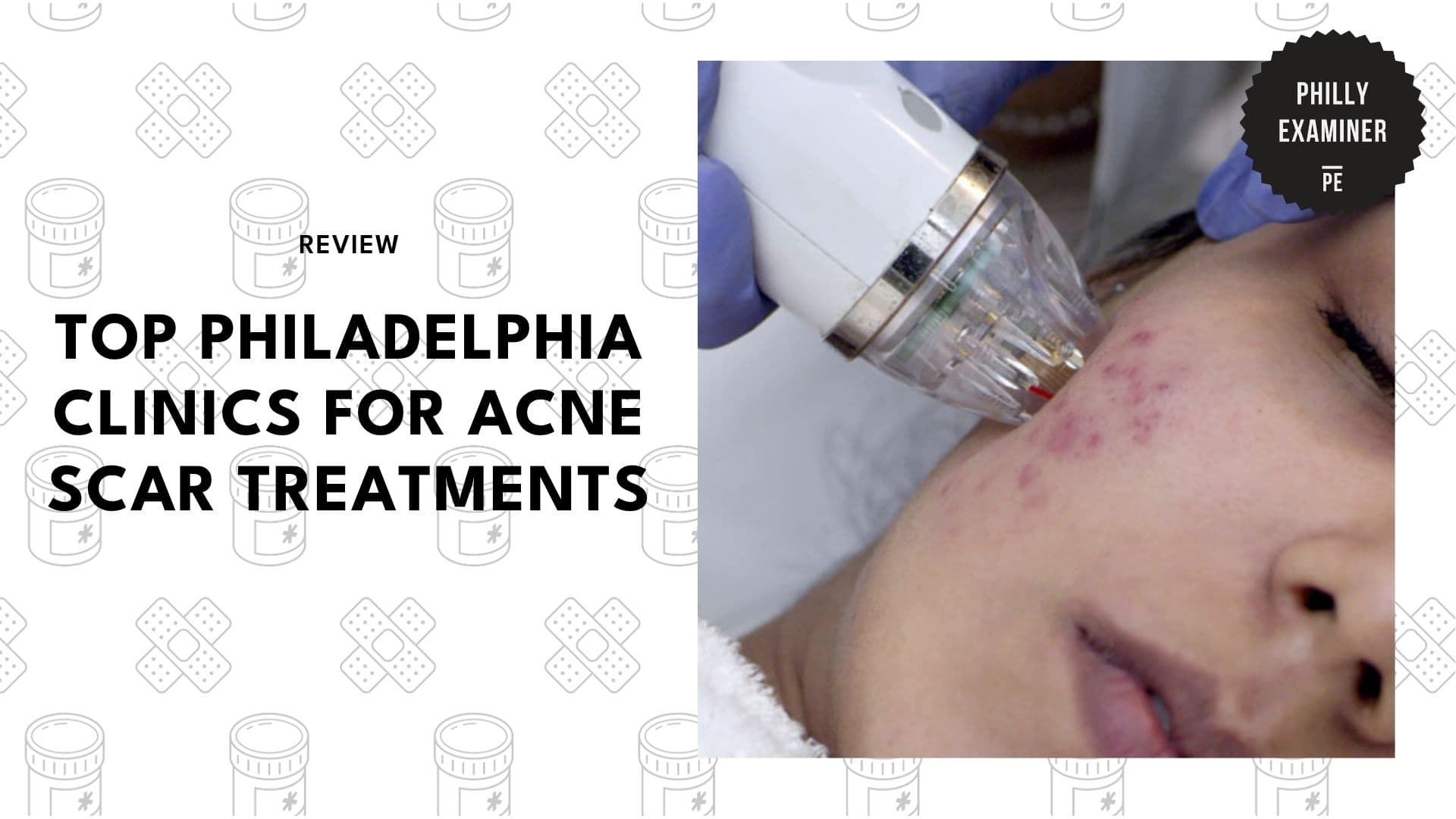 acne-scar-treatments-in-philadelphia