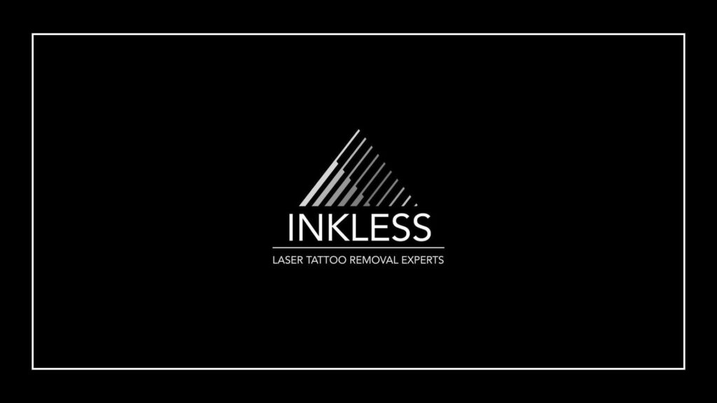 inkless-tattoo-removal
