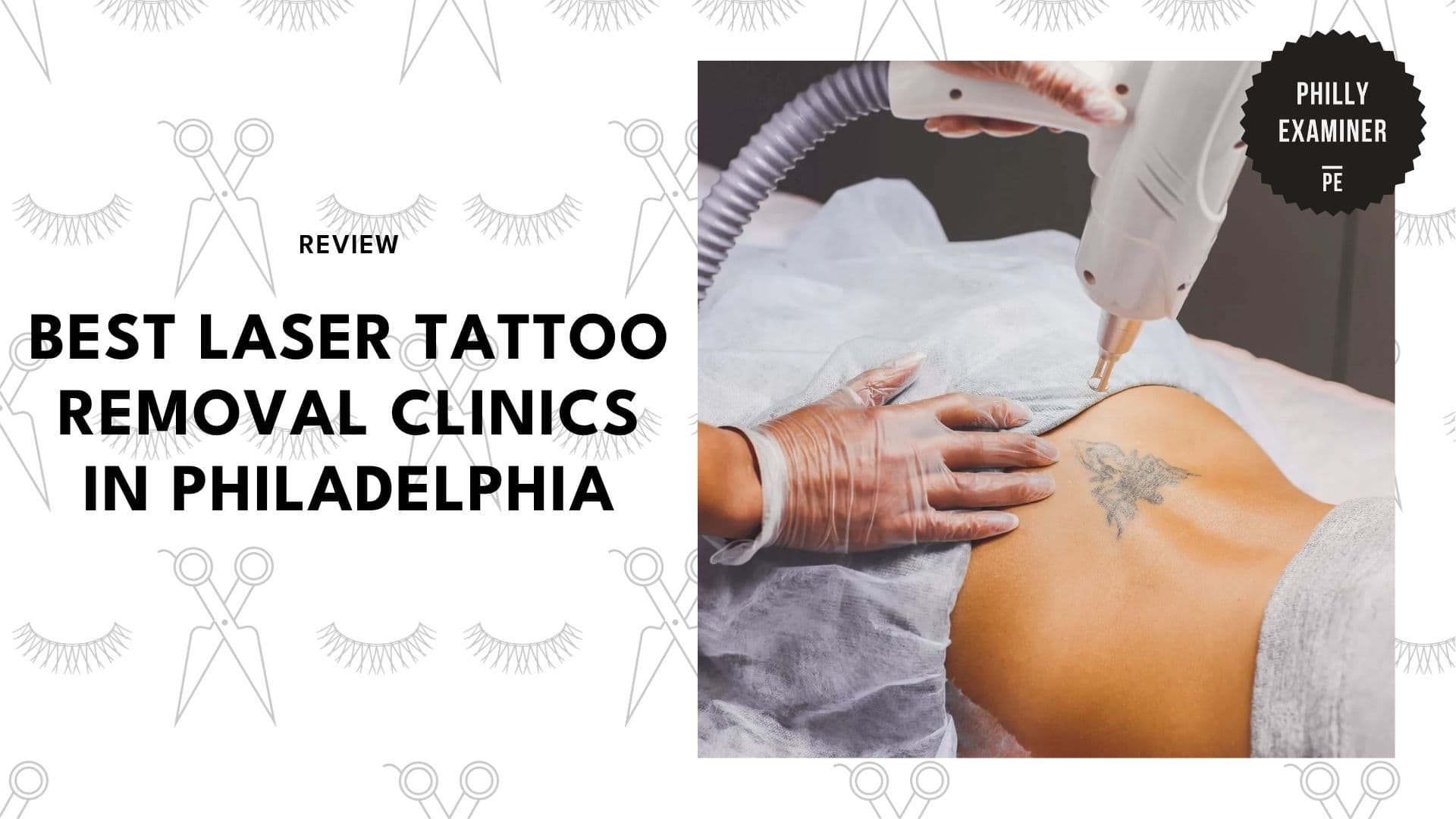 laser-tattoo-removal-services-in-philadelphia