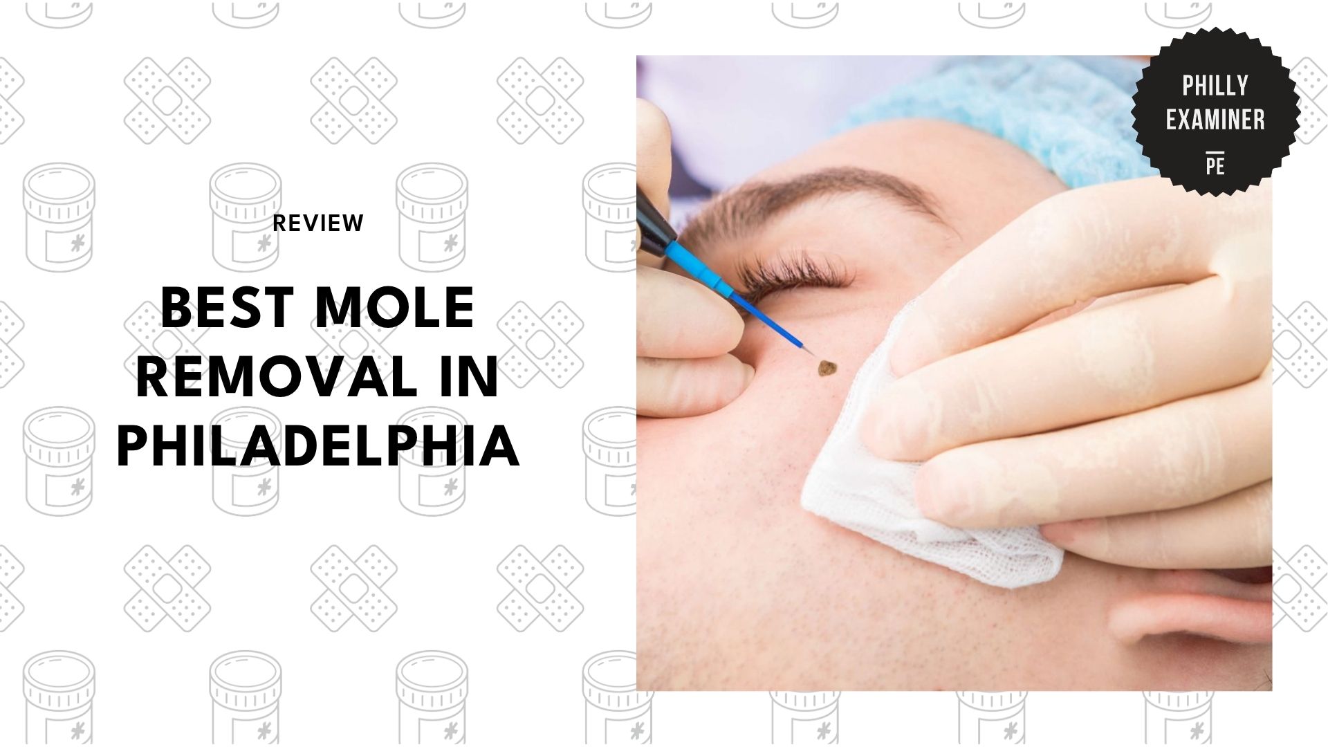best-mole-removal-philadelphia-banner